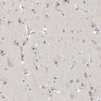 Immunohistochemical staining of human cerebral cortex shows strong positivity in nucleoli in neurons.