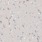 Immunohistochemical staining of human cerebral cortex shows strong positivity in nucleoli in neurons.