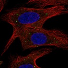 Anti-ABCB9 Antibody