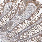 Immunohistochemical staining of human gastrointestinal shows moderate membranous positivity in glandular cells.