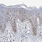 Immunohistochemical staining of human skin shows strong positivity in nucleoli in squamous epithelial cells.
