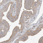 Immunohistochemical staining of human fallopian tube shows moderate membranous positivity in glandular cells.