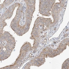 Immunohistochemical staining of human fallopian tube shows moderate membranous positivity in glandular cells.