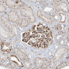 Immunohistochemical staining of human kidney shows strong membranous positivity in cells in glomeruli.