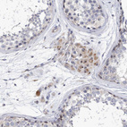 Immunohistochemical staining of human testis shows strong positivity in nucleoli in Leydig cells.