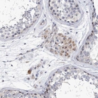 Immunohistochemical staining of human testis shows strong positivity in nucleoli in Leydig cells.