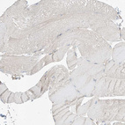 Immunohistochemical staining of human skeletal muscle shows no positivity in myocytes as expected.