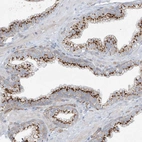 Immunohistochemical staining of human prostate shows strong cytoplasmic granular positivity in glandular cells.