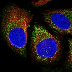 Immunofluorescent staining of human cell line U-2 OS shows localization to vesicles.