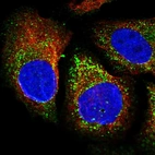 Immunofluorescent staining of human cell line U-2 OS shows localization to vesicles.