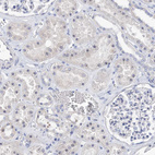 Immunohistochemical staining of human kidney shows moderate positivity in nucleoli in cells in tubules.