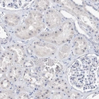 Immunohistochemical staining of human kidney shows moderate positivity in nucleoli in cells in tubules.