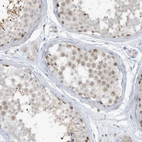 Anti-PRRT3 Antibody