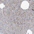 Immunohistochemical staining of human pancreas shows strong cytoplasmic granular positivity in exocrine glandular cells.
