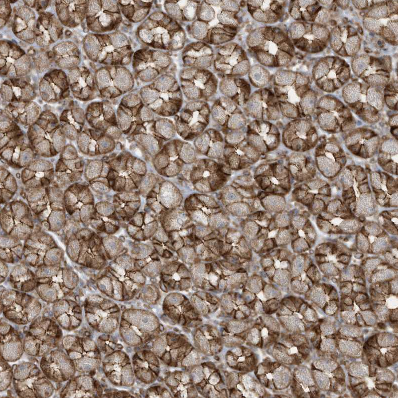 Anti-SLC9A2 Antibody