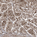 Anti-SLC9A2 Antibody