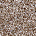 Anti-SLC9A2 Antibody