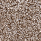 Anti-SLC9A2 Antibody