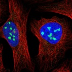 Immunofluorescent staining of human cell line U-2 OS shows localization to nucleoli.