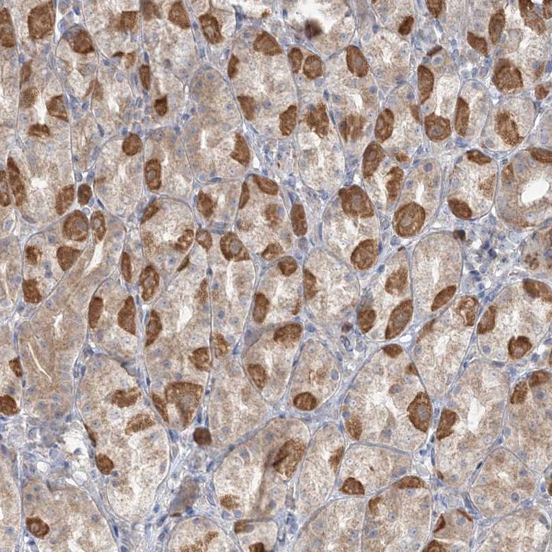 Anti-TBC1D5 Antibody