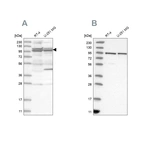 Western blot analysis using Anti-TBC1D5 antibody HPA035126 (A) shows similar pattern to independent antibody HPA035125 (B).