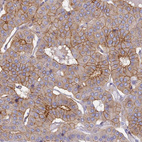 Immunohistochemical staining of human parathyroid gland shows strong membranous positivity in glandular cells.