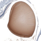 Immunohistochemical staining of rat eye shows strong cytoplasmic positivity in lens fiber cells.