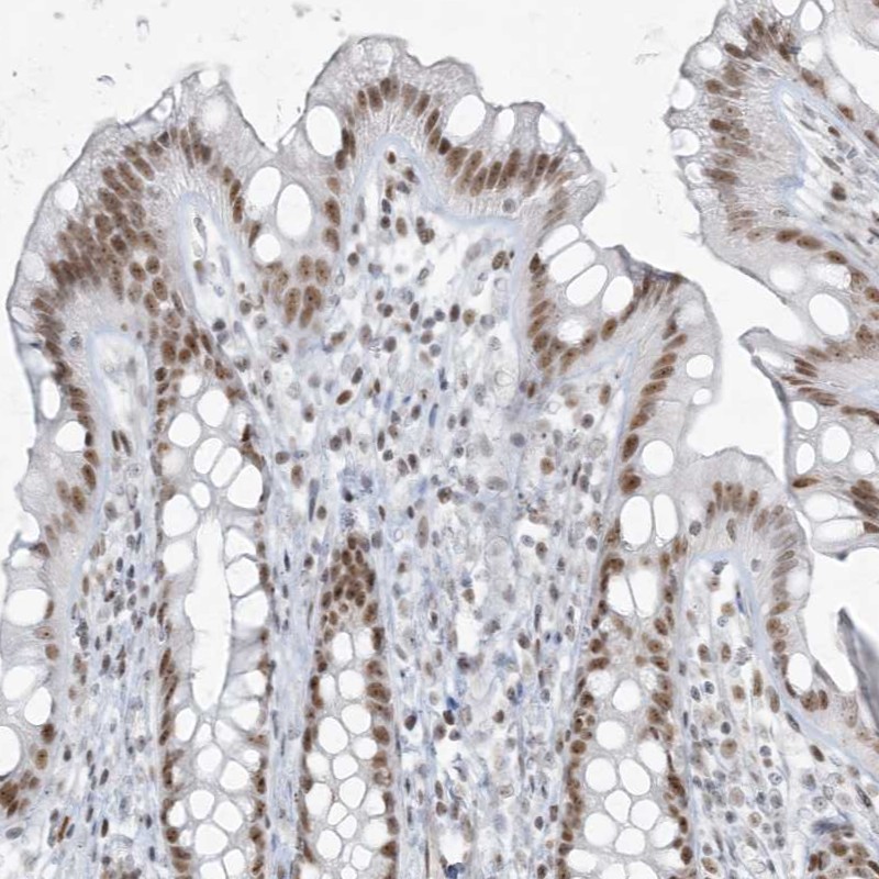 Anti-ZNF787 Antibody