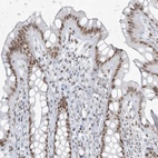 Anti-ZNF787 Antibody