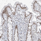 Anti-ZNF787 Antibody