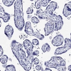 Immunohistochemical staining of human placenta shows no cytoplasmic positivity in trophoblastic cells as expected.