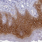 Immunohistochemical staining of human skin shows strong membranous positivity in epidermal cells.