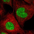 Immunofluorescent staining of human cell line A-431 shows localization to nucleus & nucleoli.