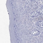 Immunohistochemical staining of human skin shows no cytoplasmic positivity in squamous epithelial cells as expected.