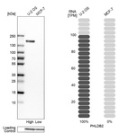 Western blot analysis in human cell lines U2OS and MCF-7 using Anti-PHLDB2 antibody. Corresponding PHLDB2 RNA-seq data are presented for the same cell lines. Loading control: Anti-GAPDH.