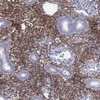 Immunohistochemical staining of human endometrium shows strong membranous positivity in cells in endometrial stroma.