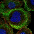 Immunofluorescent staining of human cell line A-431 shows localization to plasma membrane & cytosol.