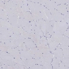 Immunohistochemical staining of human skeletal muscle shows no cytoplasmic positivity in myocytes as expected.