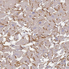 Immunohistochemical staining of human heart muscle shows strong membranous positivity in cardiomyocytes.