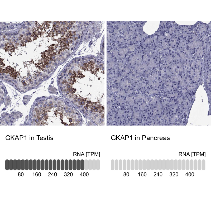 Anti-GKAP1 Antibody