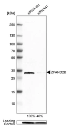 Western blot analysis in Hep-G2 cells transfected with control siRNA, target specific siRNA probe #1, using Anti-ZFAND2B antibody. Remaining relative intensity is presented. Loading control: Anti-PPIB.