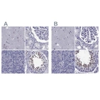 Immunohistochemical staining of human cerebral cortex, kidney, pancreas and testis using Anti-GKAP1 antibody HPA035118 (A) shows similar protein distribution across tissues to independent antibody HPA066173 (B).