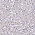 Immunohistochemical staining of human liver shows no positivity in hepatocytes as expected.