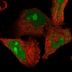 Immunofluorescent staining of human cell line U-251 MG shows localization to nucleus & nucleoli.