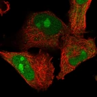 Immunofluorescent staining of human cell line U-251 MG shows localization to nucleus & nucleoli.