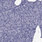 Immunohistochemical staining of human pancreas shows low expression as expected.