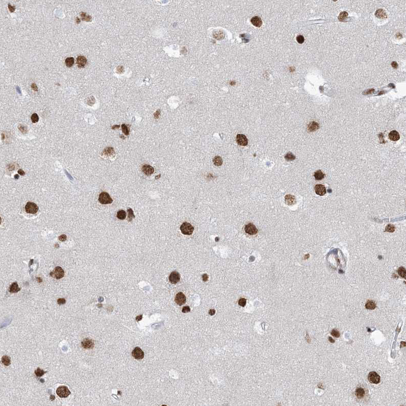Anti-ZNF792 Antibody