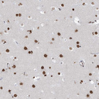 Anti-ZNF792 Antibody