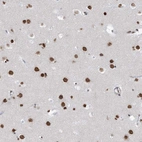 Anti-ZNF792 Antibody