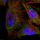 Immunofluorescent staining of human cell line U-251 MG shows localization to vesicles.